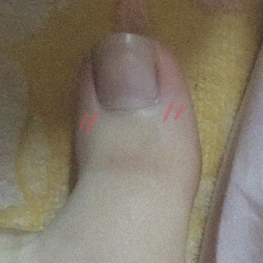 ROPANG0402의 엄지발가락