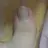 엄지발가락