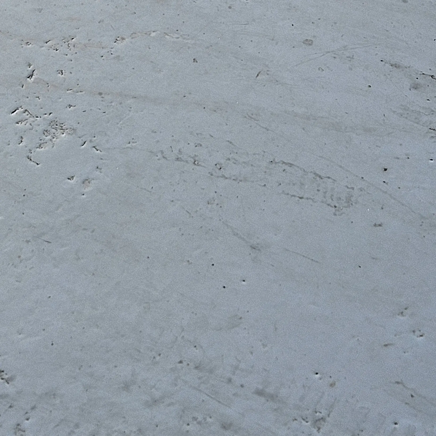 PainedWool6157의 환자