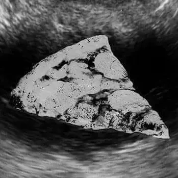 NumbCage6746의 오빠