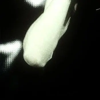 page.Luna의 醜形恐怖症の彼氏。