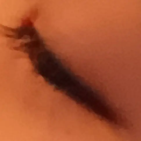 ItchyBloom0568의 弟