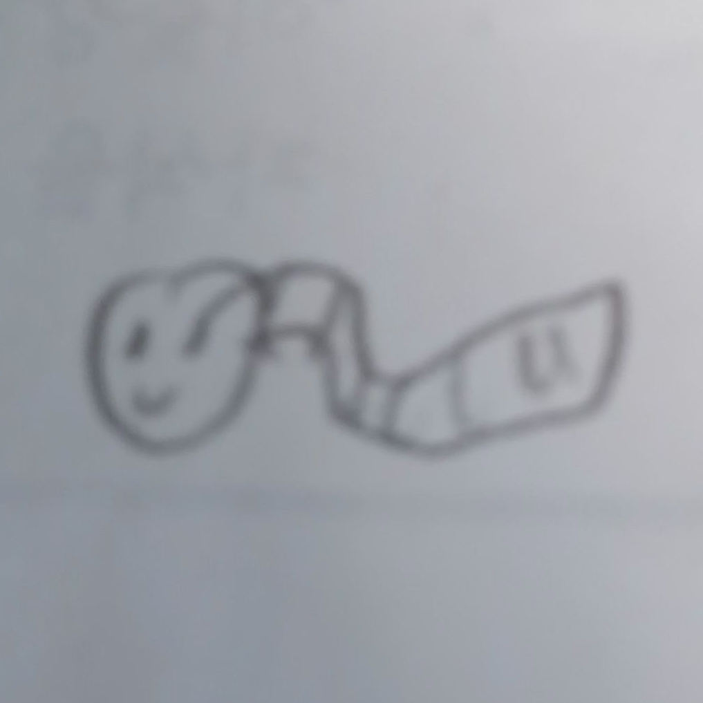 포세이큰 외계인손 증후군 대표 이미지