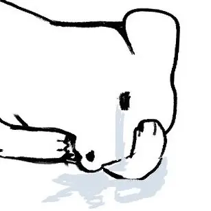 _d4mudemu의 치질