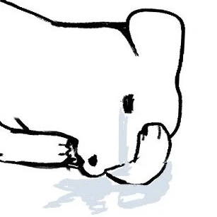 치질