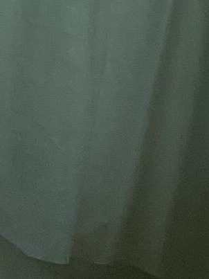 수인의 신체부분을 대신한 기계장치들. 대표 이미지