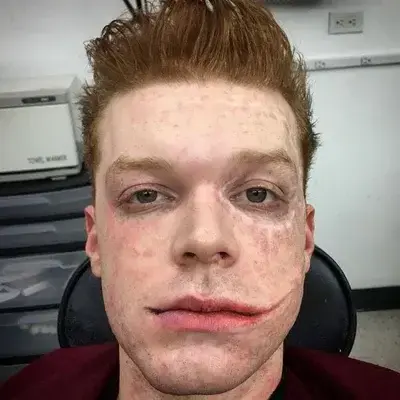 SneakyAlert2473의 Jerome Valeska