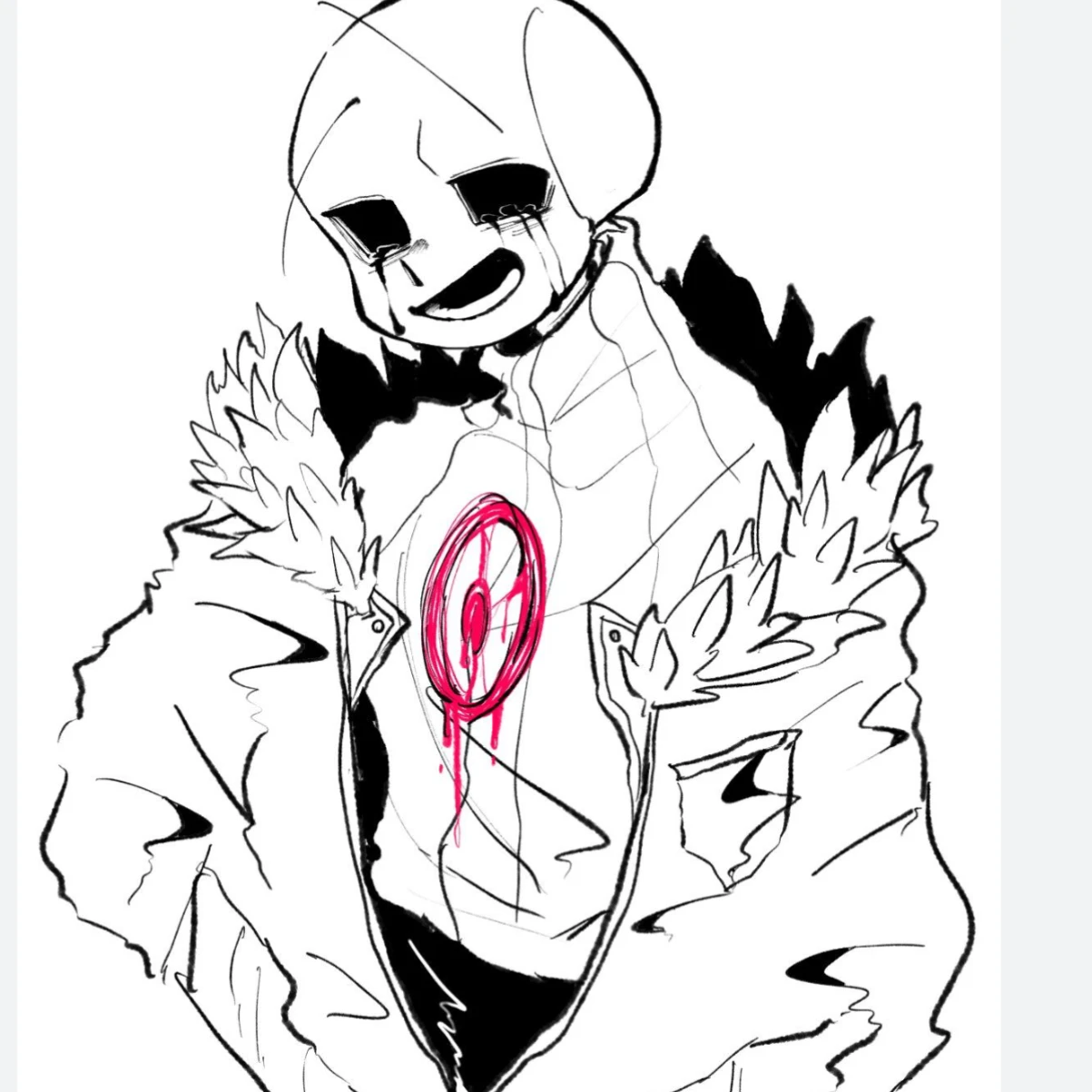 킬러