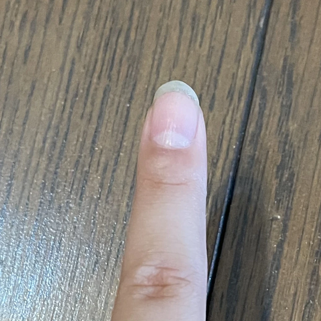 指