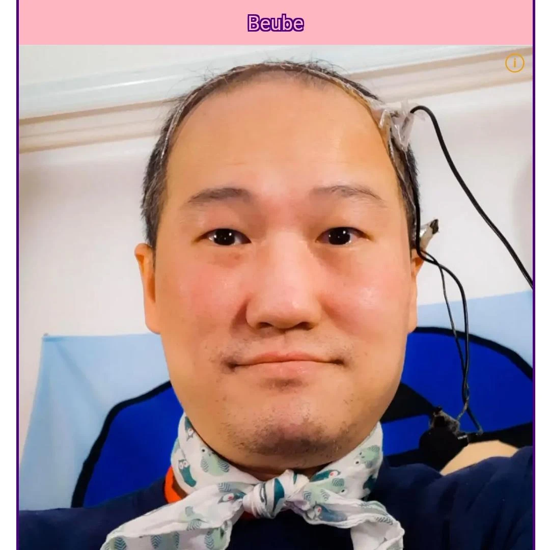 브베