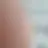 알페르