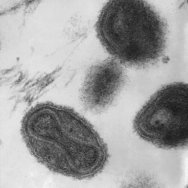 Profile image of VARV