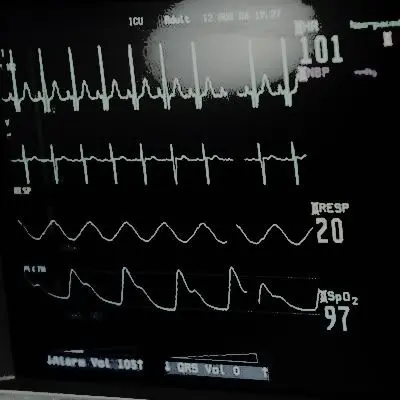 GanJang6의 박찬솔
