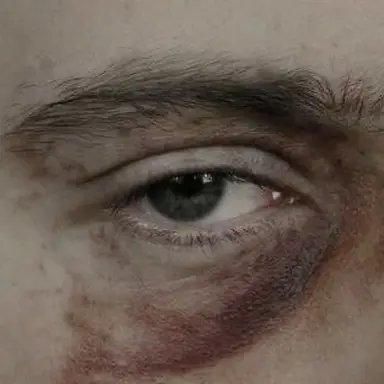 Profile image of 헤럴드 핀치