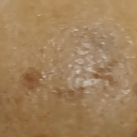 명
