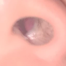 저혈압 치료제