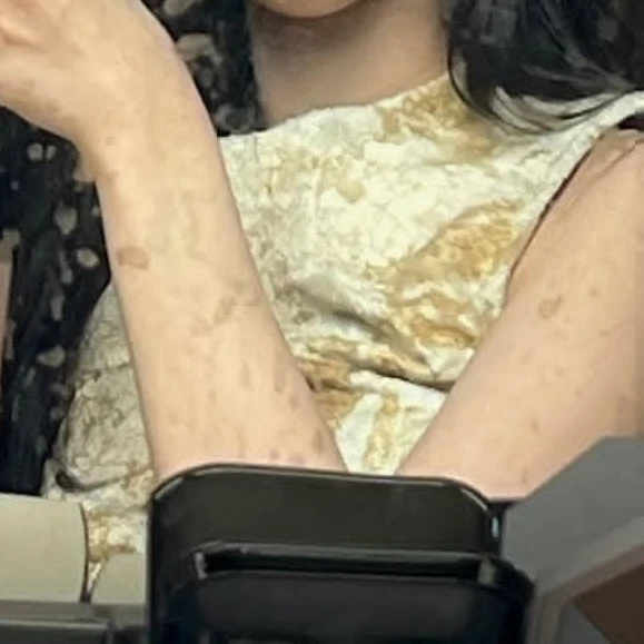 백지헌