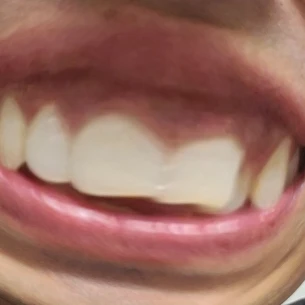 돼지