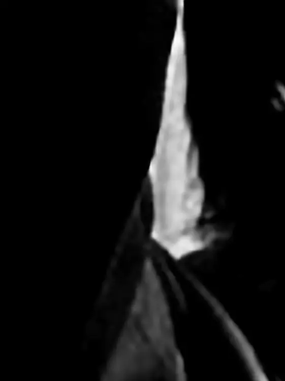 green.ringo.의 暗い色