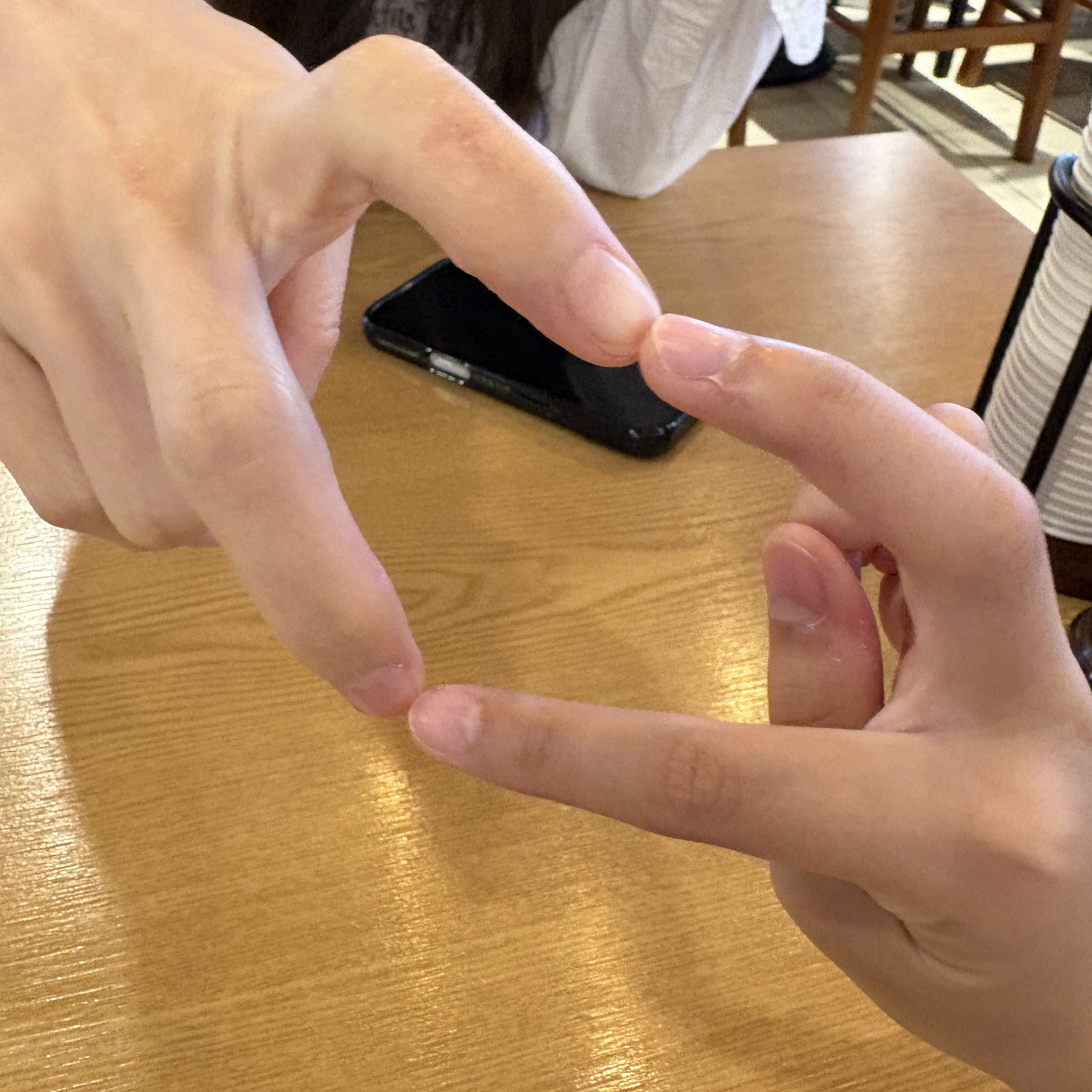 교통사고를 당했는데 범인이 여우?! 대표 이미지