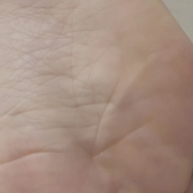 여친