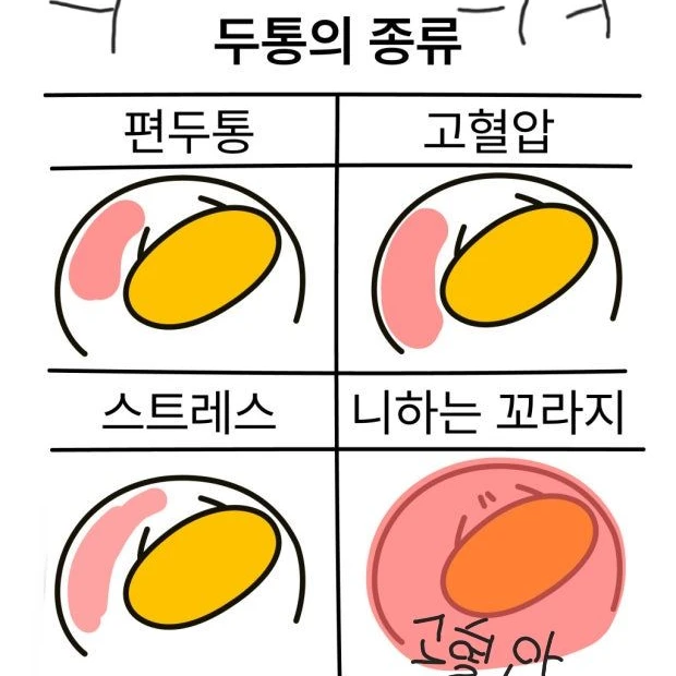사이먼