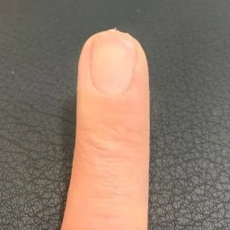 부러진 손톱