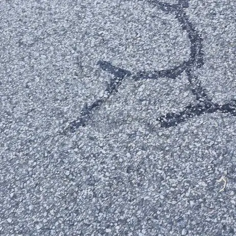 GreasyFob9848의 유이가 병원을?