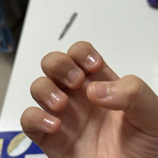 ㅎㅎ