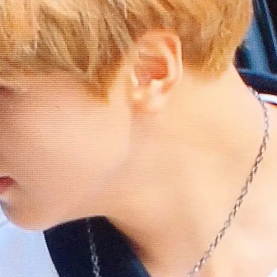 NCT의 -