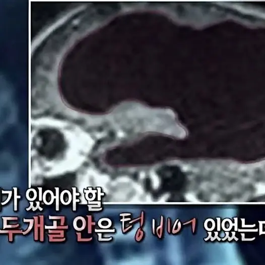 FlushMule0983의 포세이큰 학교 수학여행 (여우 포함)