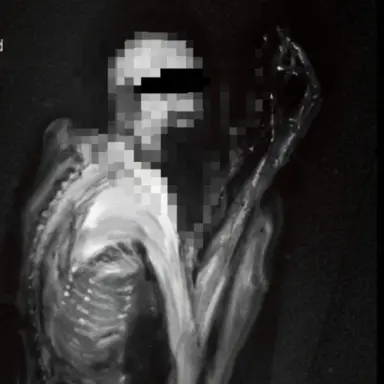 Profile image of SCP-096