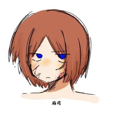 Profile image of 麻疹